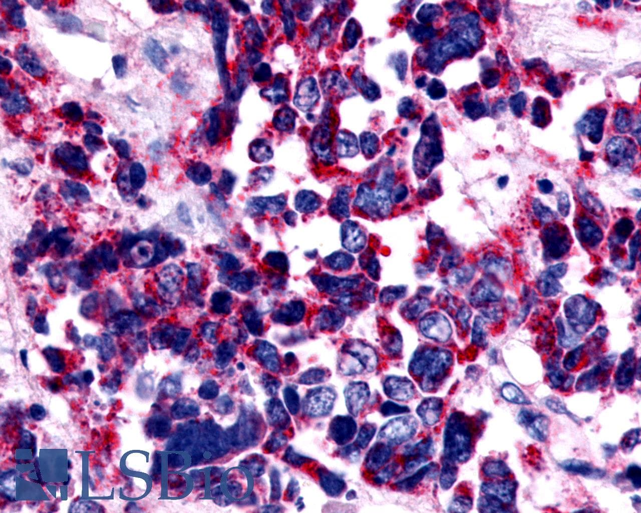 PathPlus™ EDNRA / Endothelin A Receptor Antibody (Extracellular Domain)