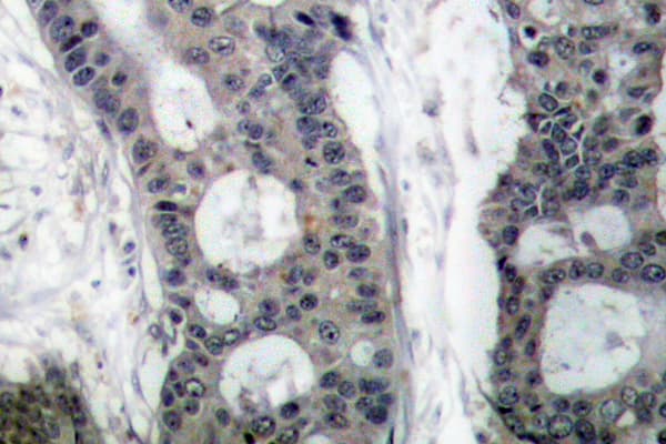 EIF4E Antibody (Thr203)