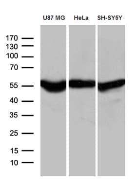Monoclonal Mouse anti-Human GDI1 Antibody (clone OTI8B2, Carrier-free, WB)