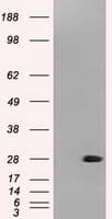 Monoclonal Mouse anti-Human NEUROG1 / NGN1 / Neurogenin 1 Antibody (clone OTI8G8, IF, WB)