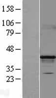 HPDL Protein (Over-Expression Lysate Myc-DDK (Flag))
