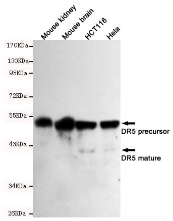 TNFRSF10B / Killer / DR5 Antibody