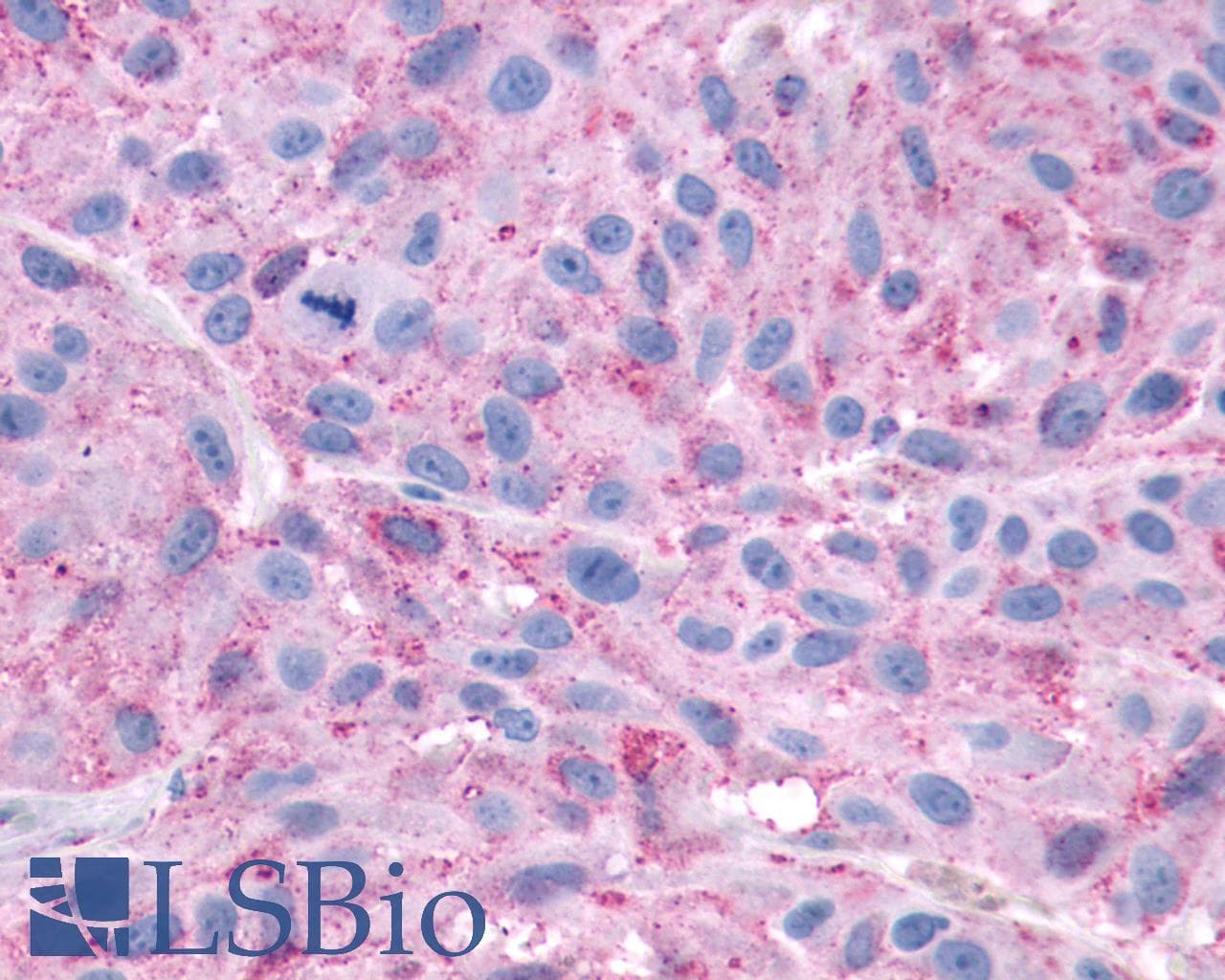 PathPlus™ Polyclonal Rabbit anti-Human CXCR3 Antibody (C-Terminus, IHC)