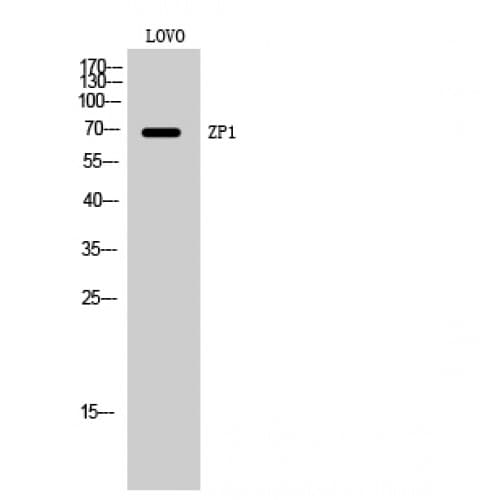 ZP1 Antibody (190-270 aa, Internal)