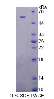 Human EEF2K Protein (Recombinant His-T7, N-terminus)