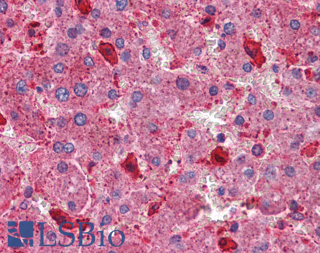 IHC-plus™ Hamartin / TSC1 Antibody (aa1150-1163)