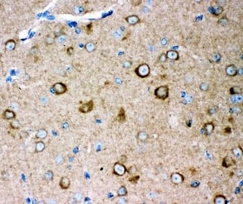 GRM2 / MGLUR2 Antibody (aa25-360)