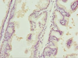 Polyclonal Rabbit anti-Human HT2A / TRIM32 Antibody (IHC)