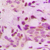 Polyclonal Rabbit anti-Human HNRNPD / AUF1 Antibody (Internal, IHC, IF, WB)