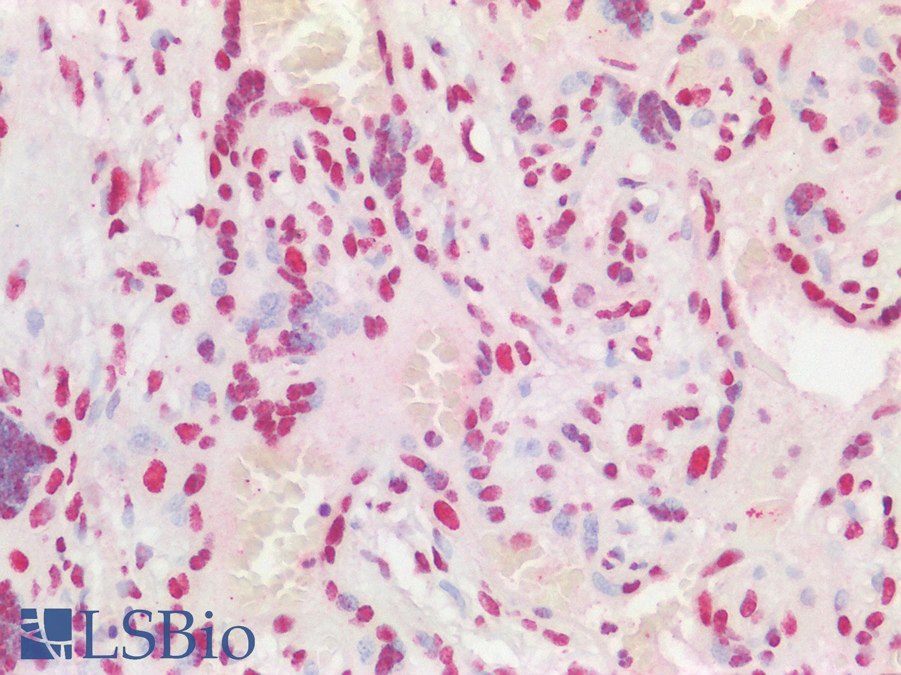 AATF Antibody (aa171-220)