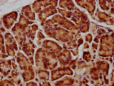 Polyclonal Rabbit anti-Human SIRPA / CD172a Antibody (IHC, IF)