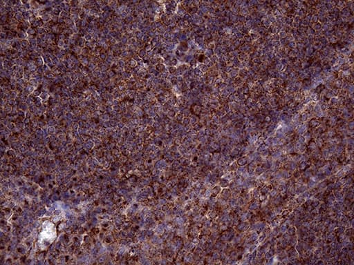 CLTA / LCA Antibody (clone OTI2D12, Carrier-free)