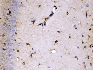 Polyclonal Rabbit anti-Human ALDH7A1 Antibody (IHC, WB)