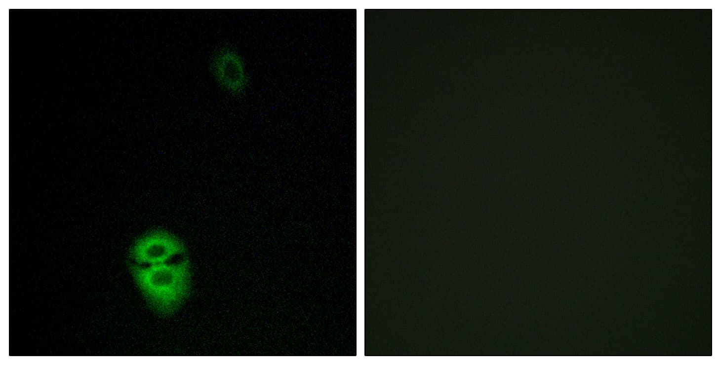 OR4K17 Antibody (aa263-312)