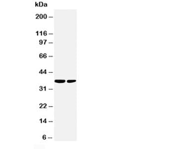 PP2Ac / PPP2CA Antibody (aa6-20)