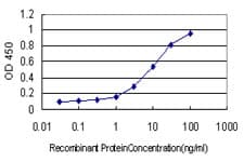RNASEL / RNase L Antibody (clone 3B4)