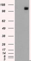 Monoclonal Mouse anti-Human L1CAM Antibody (clone OTI2H5, IHC, IF, WB)