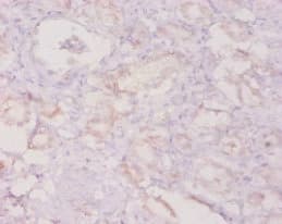 CSF3 / G-CSF Antibody