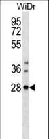 Polyclonal Rabbit anti-Human THAP10 Antibody (aa83-112, WB)