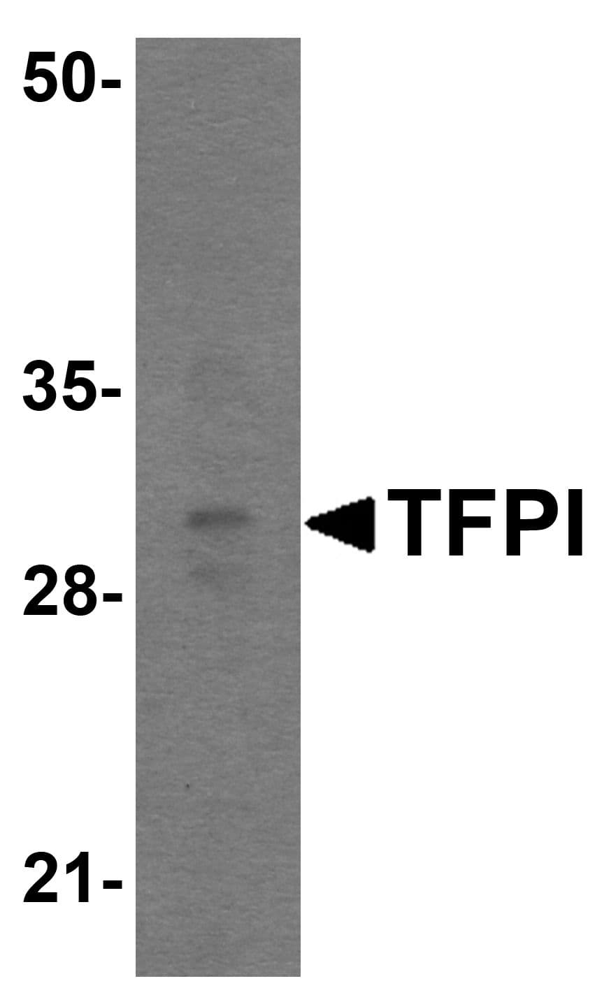 IHC-plus™ Polyclonal Rabbit anti-Human TFPI / LACI Antibody (IHC, IF, WB)