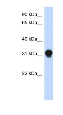 Polyclonal Rabbit anti-Human DNALI1 Antibody (N-Terminus, WB)