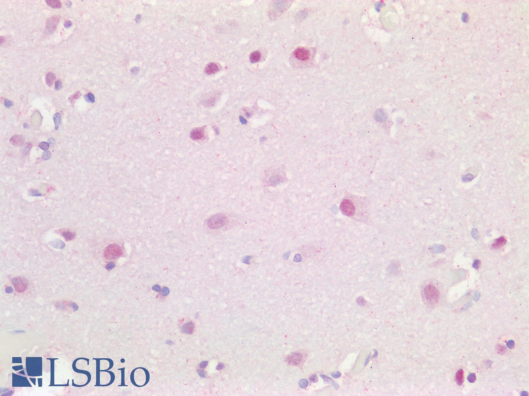 Polyclonal Rabbit anti-Human ALG11 Antibody (aa360-409, IHC, WB)