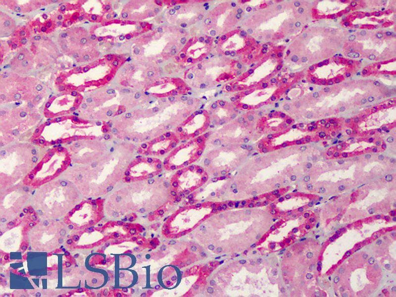 IHC-plus™ ALDOA / Aldolase A Antibody (Lyophilized)