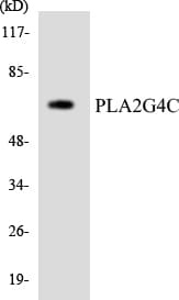 Polyclonal Rabbit anti-Human PLA2G4C Antibody (aa286-335, WB)
