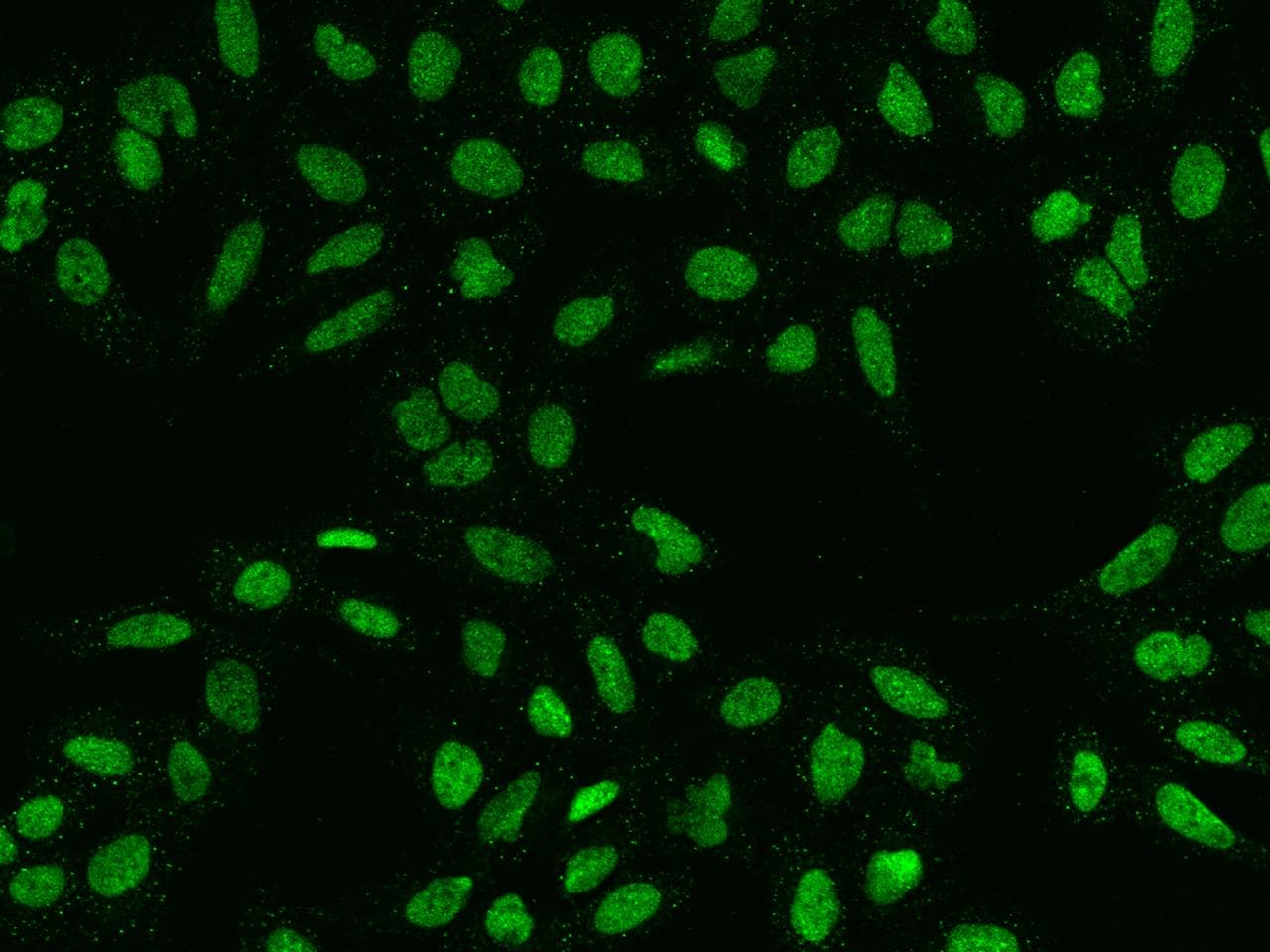 HMG20A Antibody