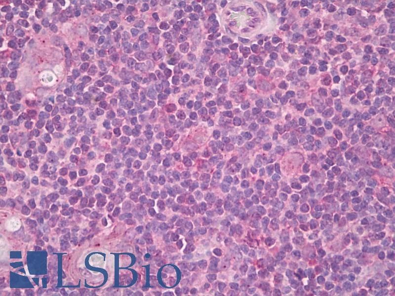 CD275 / B7-H2 / ICOS Ligand Antibody (aa197-246)