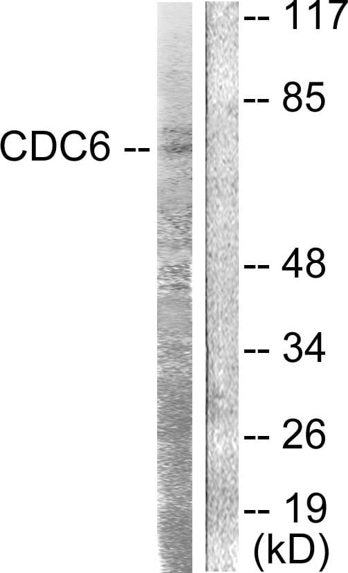 CDC6 Antibody (aa20-69)