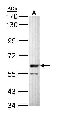 IHC-plus™ Polyclonal Rabbit anti-Human PPP3CB Antibody (aa1-228, IHC, WB)