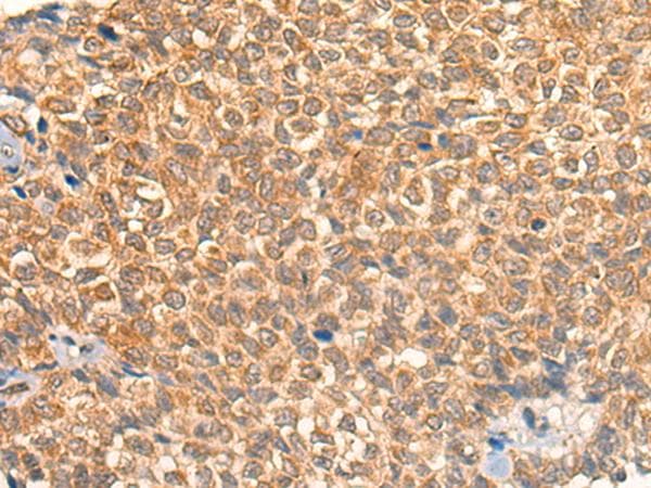 TERE1 / UBIAD1 Antibody
