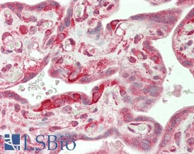 IHC-plus™ Polyclonal Rabbit anti-Human NMT1 Antibody (aa68-118, IHC, WB)