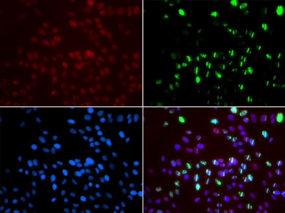 MSH6 Antibody