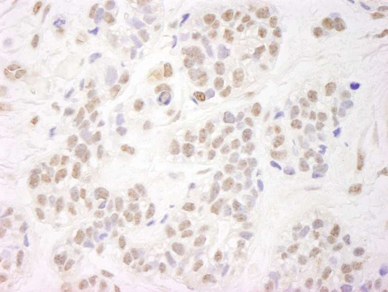 NELFA / WHSC2 Antibody (aa499-549)