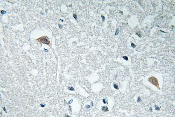 SYN1 / Synapsin 1 Antibody (Tyr3)