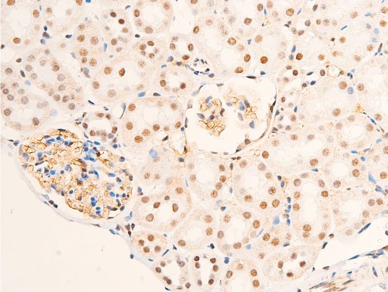 NR3C1/Glucocorticoid Receptor Antibody (phospho-Ser226)