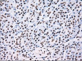 TYRO3 Antibody (clone OTI5B4)