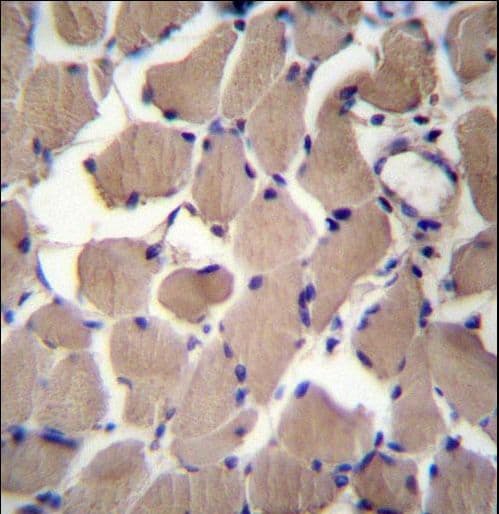 Polyclonal Rabbit anti-Human PACS2 Antibody (aa642-671, IHC, WB)