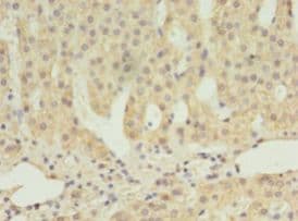 SCARB1 / SR-BI Antibody (aa33-443)