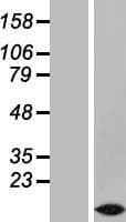 TMEM207 Protein (Over-Expression Lysate Myc-DDK (Flag))
