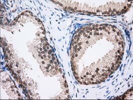 HMRF1L / MTRF1L Antibody (clone OTI1C8)