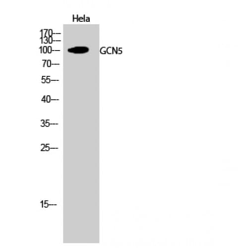 KAT2A / GCN5 Antibody (660-740 aa, C-terminal)