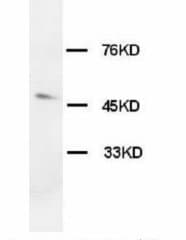 OX1R / Orexin Receptor 1 Antibody (aa1-80)