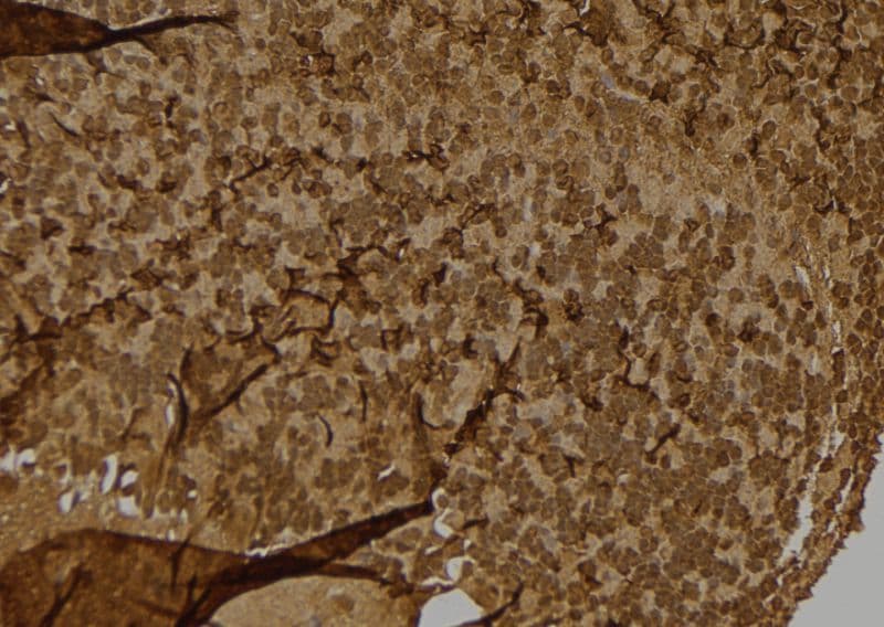 S100A4 / FSP1 Antibody