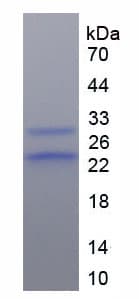 Mouse ORM1 / Orosomucoid Protein (Recombinant His)