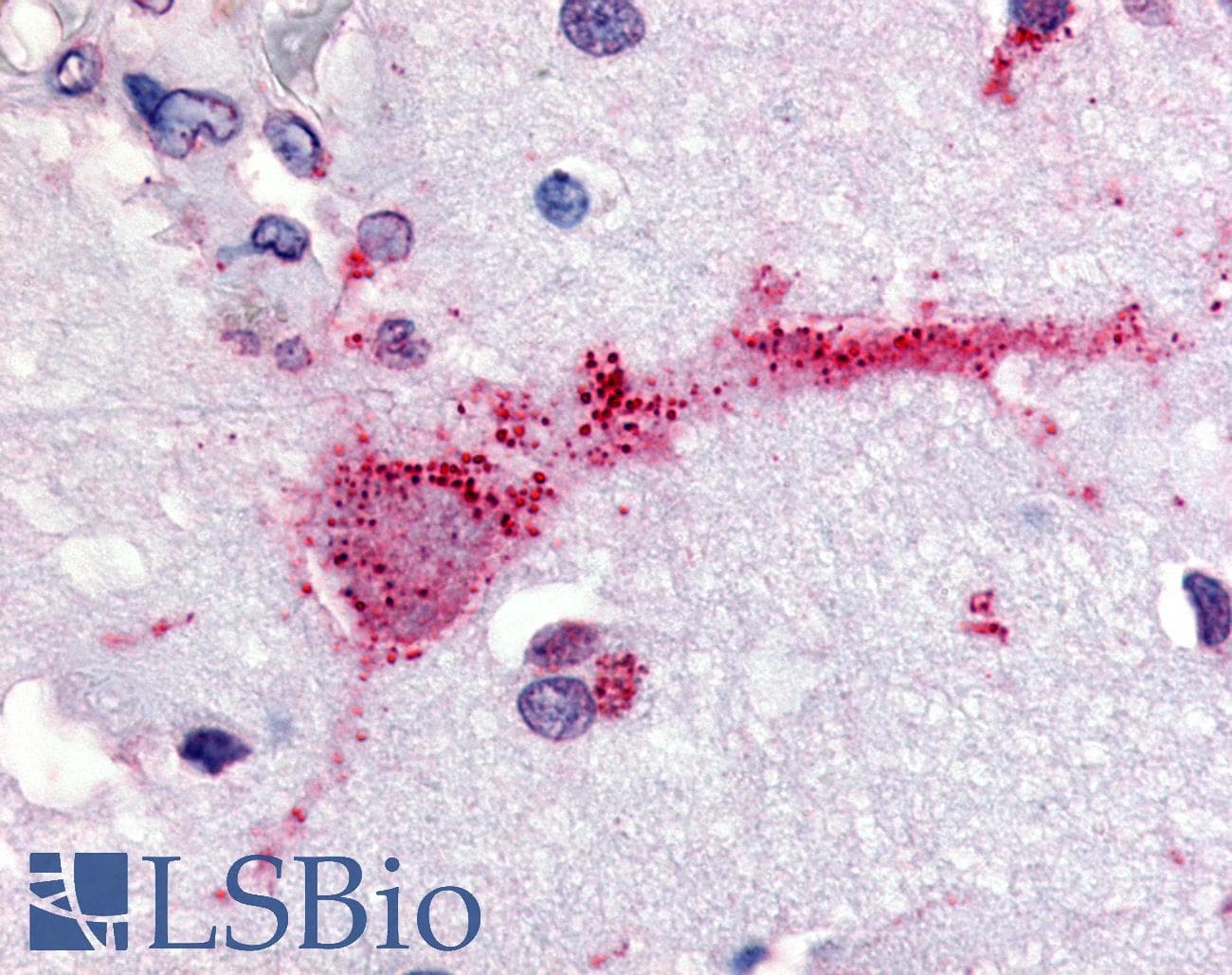 PathPlus™ Polyclonal Rabbit anti-Human GPR3 Antibody (Extracellular Domain)