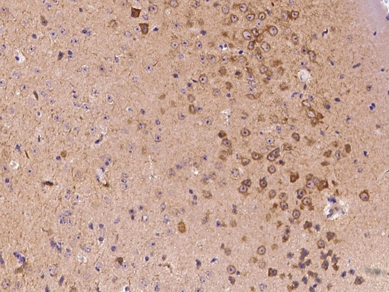 Polyclonal Rabbit anti-Mouse NEFM / NF-M Antibody (Preservative Free, IHC, WB)