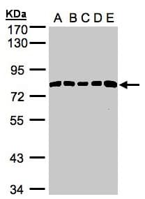 PathPlus™ PDGFRA / PDGFR Alpha Antibody